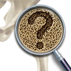 osteopenia i osteoporoza