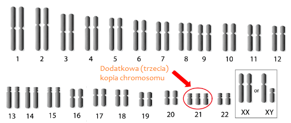 dodatkowa kopia chromosomu