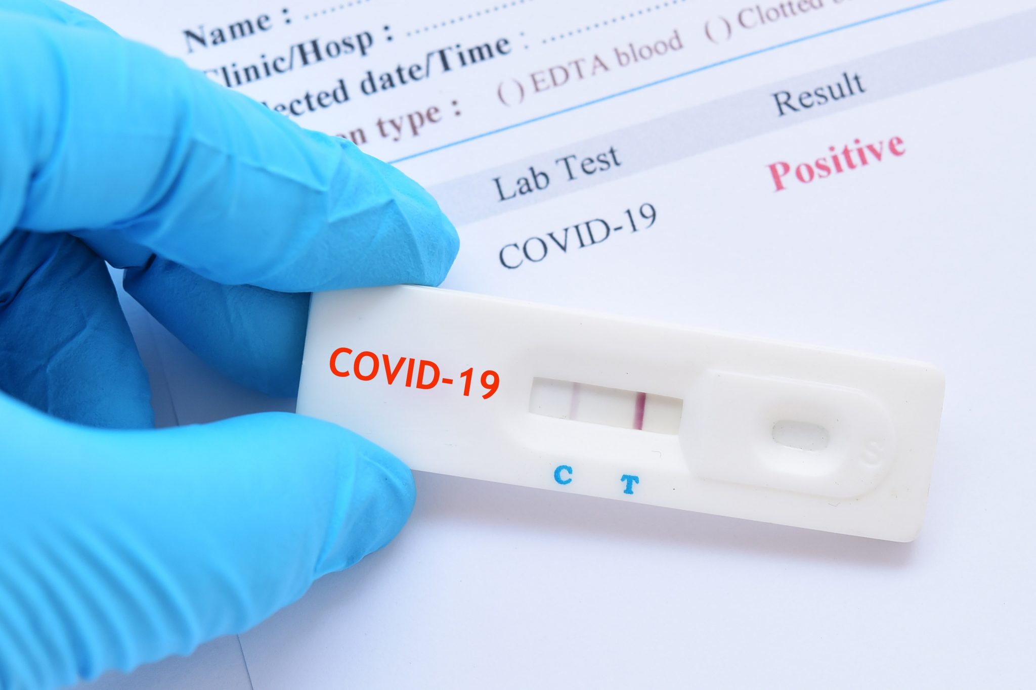 Срочный тест коронавирус