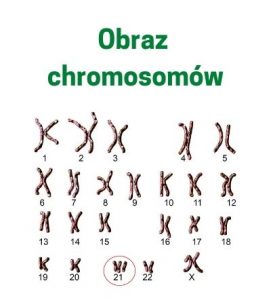badanie kariotypu