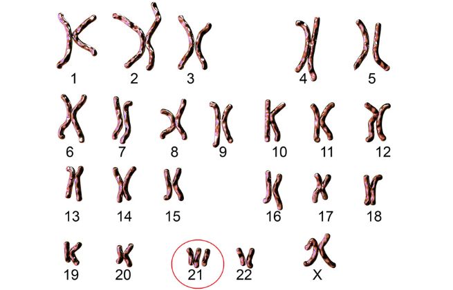 najczęściej zadawane pytania badanie kariotypu