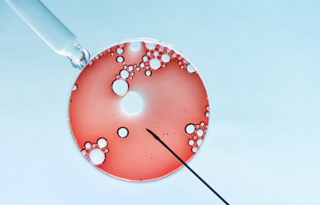 przygotowanie do in vitro