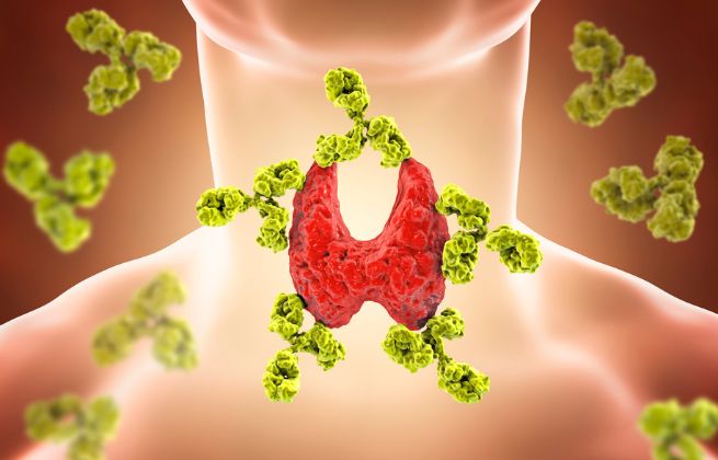 Celiakia a Hashimoto wysokie tsh czy winny może być gluten