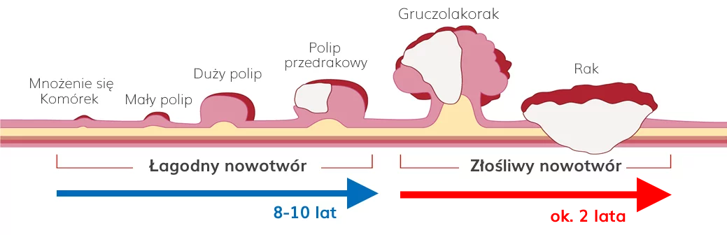 Rozwój raka jelita