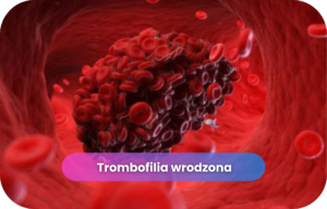 Trombofilia- badanie Trombofilia wrodzona – skrzep krwi w naczyniu krwionośnym