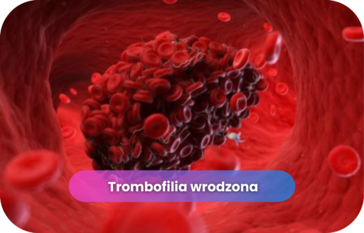 Trombofilia wrodzona – skrzep krwi w naczyniu krwionośnym